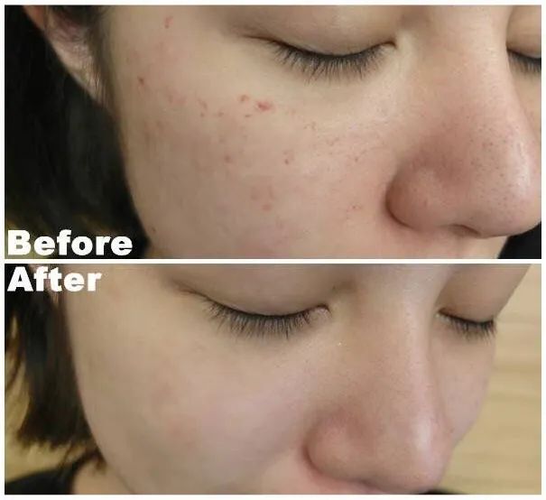 湿气重排不出去吃什么效果好,湿气重不容易瘦怎么办