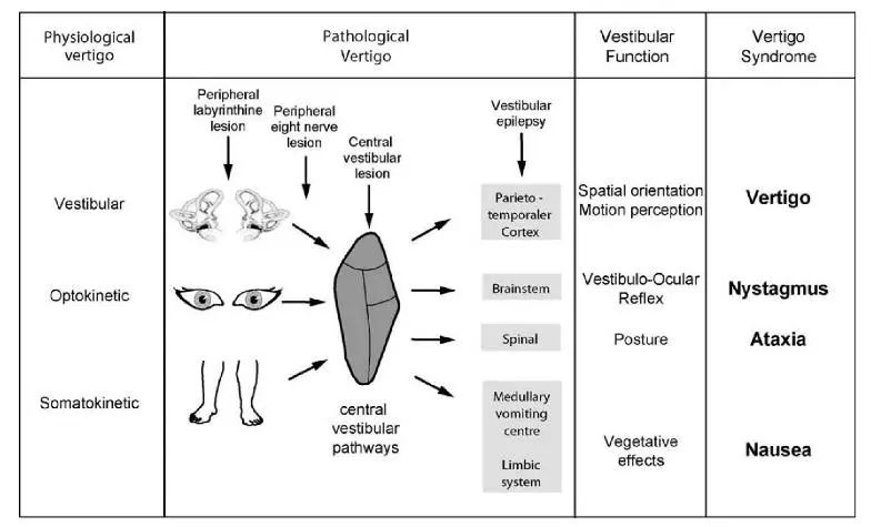 前庭眩晕康复科普,前庭康复训练方法和步骤