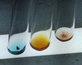 兄弟血型a型和b型有什么区别,怎么分辨血型a+和a-是什么血型