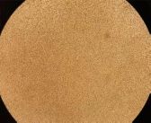 兄弟血型a型和b型有什么区别,怎么分辨血型a+和a-是什么血型