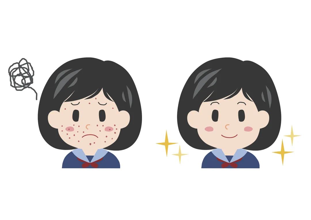 换季皮肤过敏泛红发痒小妙招,换季皮肤过敏最快解决方法