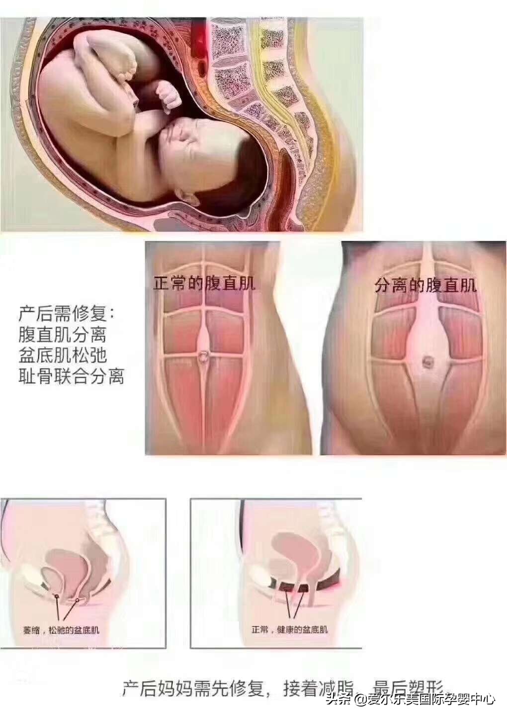 产后不锻炼后果,产后瘦身不做这一步你会越练越错