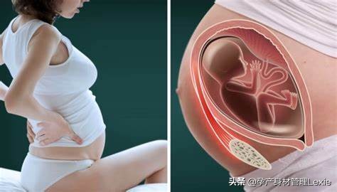 孕期为什么会出现腰痛、下背痛？真相在这里