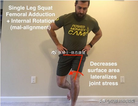 髌骨疼痛综合征康复训练,髌骨疼痛综合征是什么意思