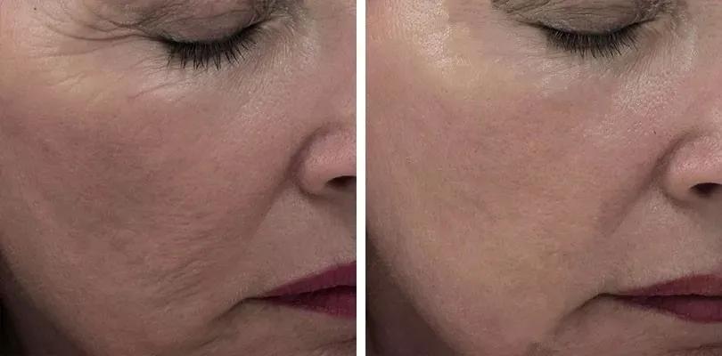 经常这样喝让你的脸色红润还养颜,每天坚持这样喝皮肤又白又嫩