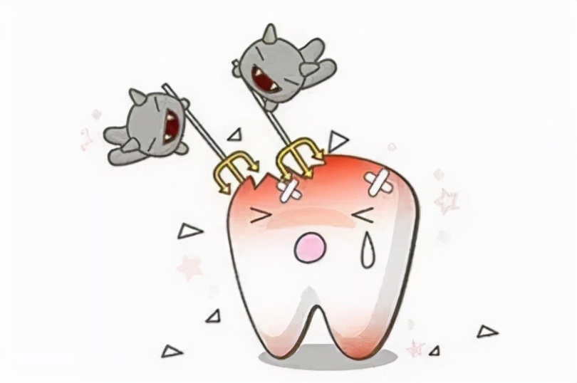 上牙戴活动假牙的亲身经历,20岁单颗戴活动假牙的真实感受