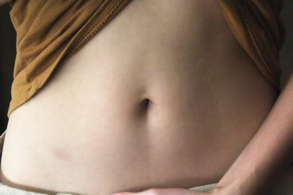 剖腹产产后腰疼怎么调理,产后老是腰疼胯骨疼咋回事