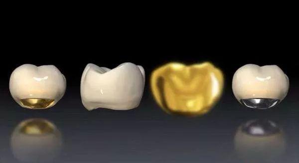 种植牙影响核磁共振和脑ct吗,种植牙能做ct核磁共振吗