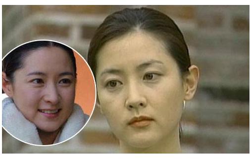 医美去除眼袋和法令纹的方法,医美脸部法令纹怎么消除