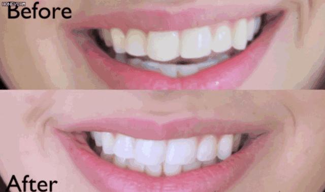 最好用的牙膏排行榜前十名,选哪个牌子的牙膏最安全好用