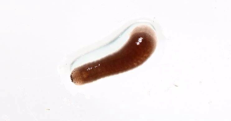 流鼻血的恐怖现象,流鼻血恐怖案例