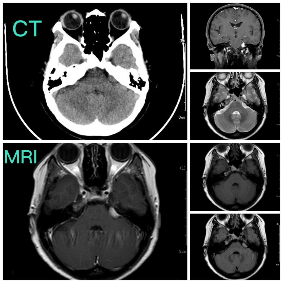 见微知著，内镜显神通