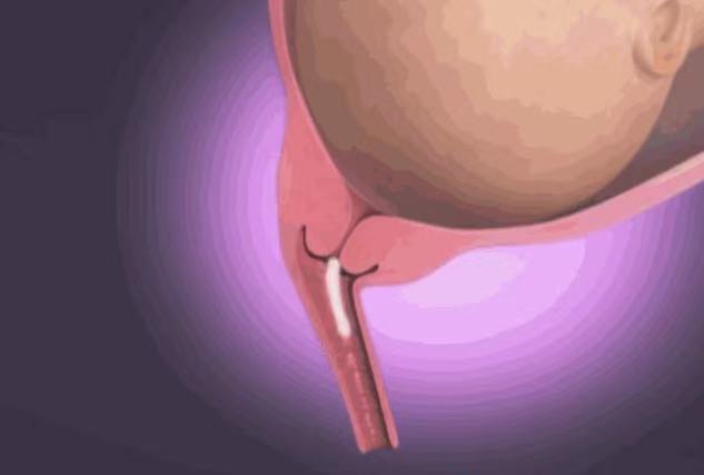 孕妇高清分娩全程图，从临产小征兆到正式胎儿娩出，早知道早准备