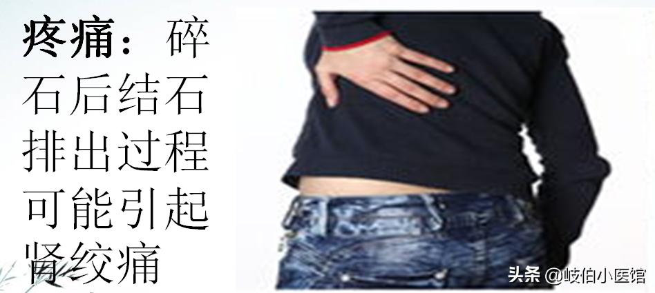 输尿管5mm结石体外冲击波碎石危害,体外冲击波碎石后尿出结石