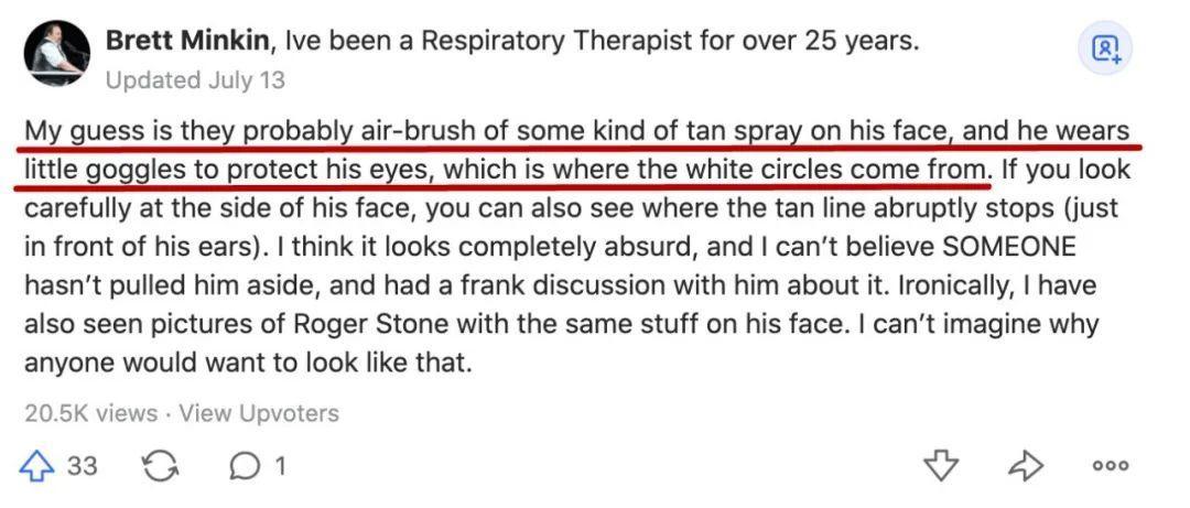 为什么特朗普的眼圈是白的,特朗普的白眼圈是怎么回事