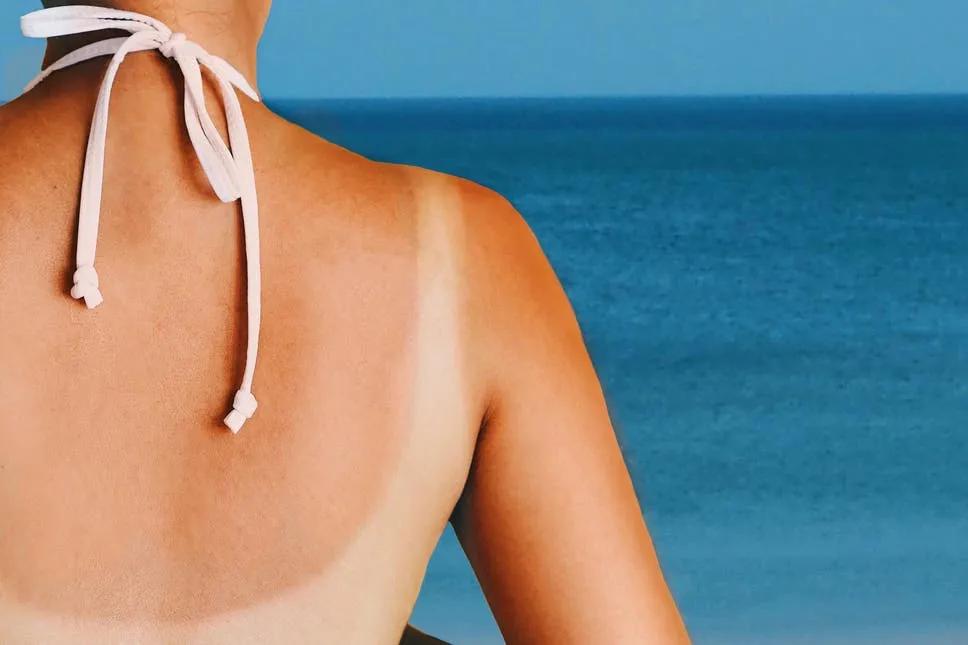 为什么皮肤被太阳晒黑不会变白,皮肤晒黑后还能变白吗