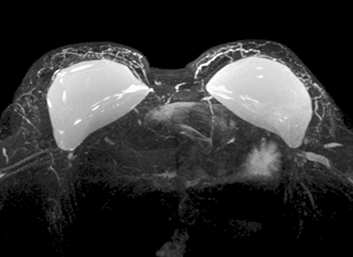 x射线下的人体图,x射线照片