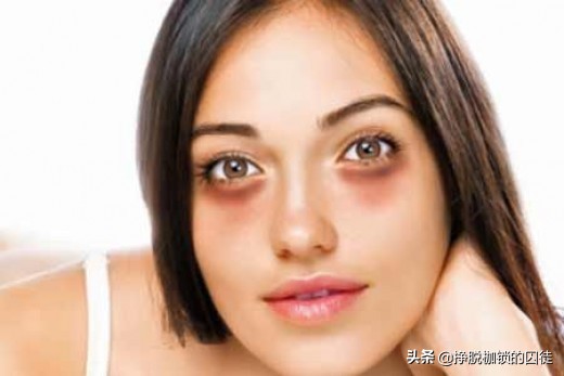 女孩黑眼圈重什么原因导致的,黑眼圈是什么原因导致的啊