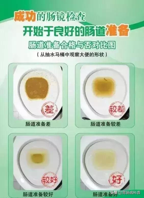 科普胶囊内镜和电子内镜该怎么选,胶囊内镜与无痛胃肠镜区别