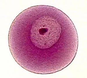 霉菌性阴道炎有什么症状能自愈吗,霉菌性阴道炎的症状怎么根治