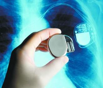 脑血管核磁共振具体检查过程,脑血管核磁共振前要注意什么