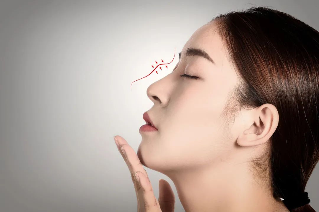 世界公认的哪几种鼻子好看,基础好的鼻子为什么做出来好看