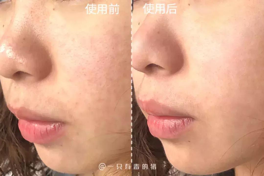 网红面膜清洁面膜,网红同款清洁面膜美白