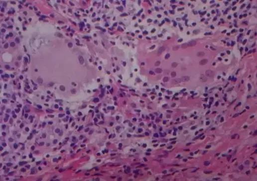 病理报告不会看？别怕，手把手教你