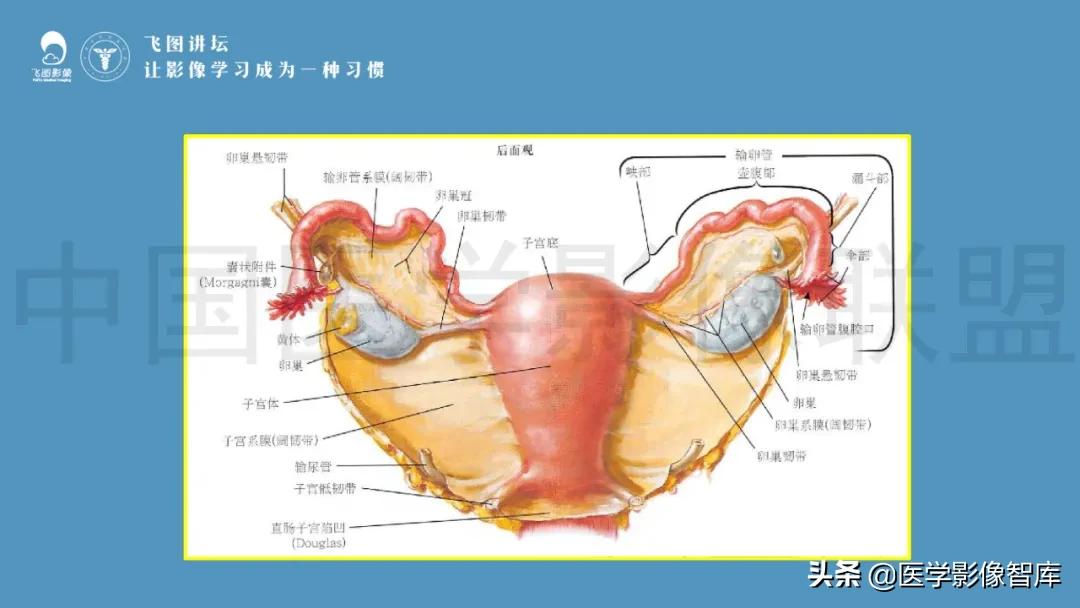 子宫解剖结构输卵管和卵巢位置,子宫附件ct影像学正常解剖表现