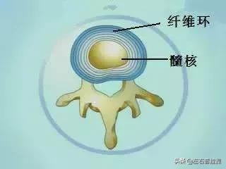 腰椎间盘突出压迫神经如何调理,腰椎间盘突出压迫神经怎么能解除
