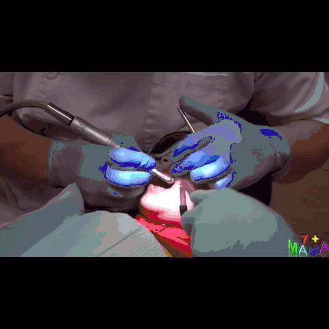 一般的刷牙方法能清除牙菌斑,小朋友牙齿有牙菌斑要洗掉吗