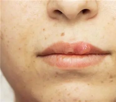 经常这样喝让你的脸色红润还养颜,每天坚持这样喝皮肤又白又嫩