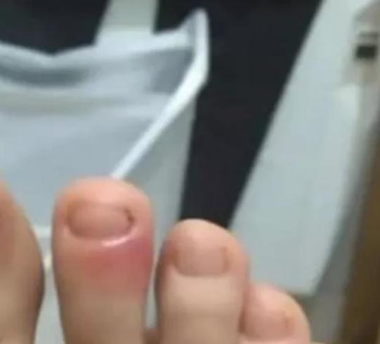 哪些国家有儿童感染新冠病毒的,现在新冠病毒儿童最新症状