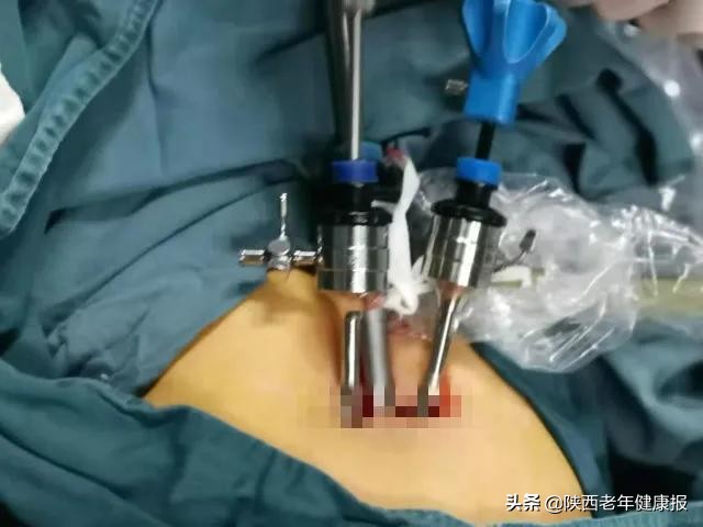 「硬核技术」男友为25岁“石女”寻医