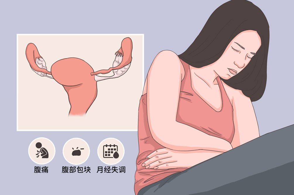 良性转移性平滑肌瘤临床十分罕见，此病一般多好发于绝经前的女性