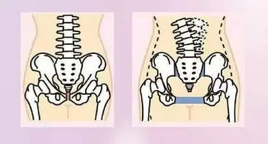 有必要去医院做产后修复吗？看完这些再做决定