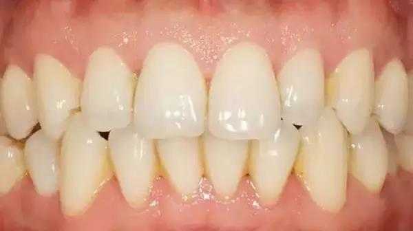 月子牙刷真的好用吗,月子牙刷好用么