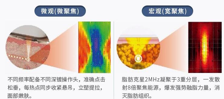 7d聚拉提和热玛吉超声刀哪个贵,热玛吉和超声刀7d哪个提拉效果好