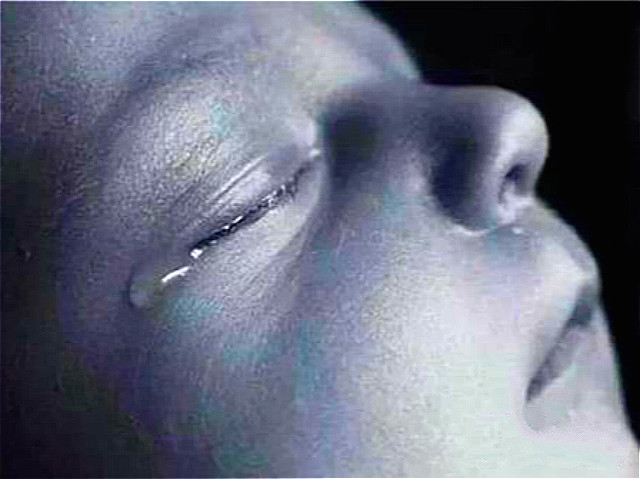 孕晚期引产胎儿是活的吗,引产的胎儿在肚子里的过程