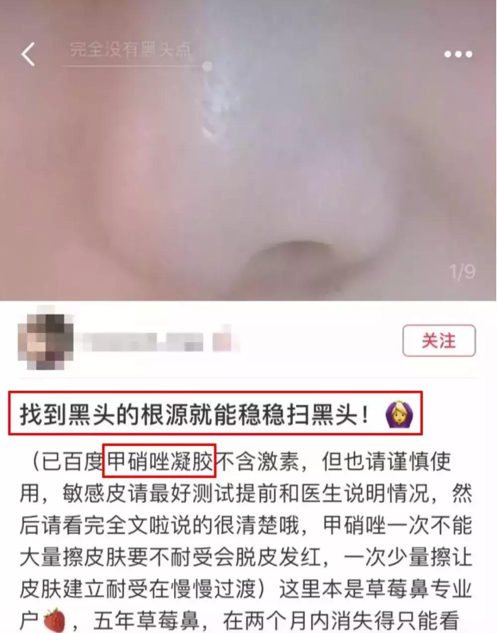 欧阳娜娜擦的药膏,欧阳娜娜擦什么药膏