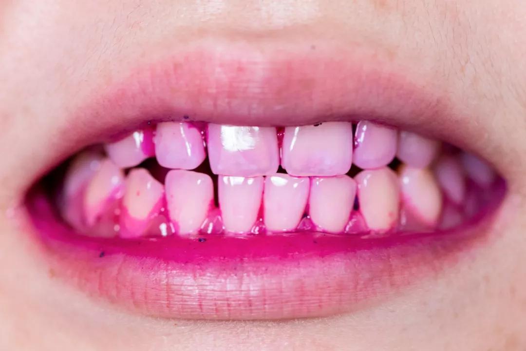 护齿儿童牙膏,护齿牙膏儿童防蛀牙