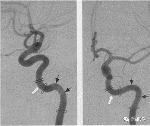 人体神经系统完整解剖图,超全神经系统解剖图近乎完美
