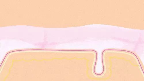 脸上不同部位长痘对应器官有问题,脸上长痘部位对应内脏