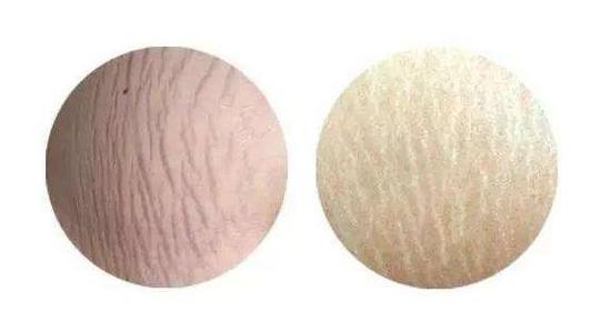 新婚发现肚子上有妊娠纹,新婚夜发现媳妇肚子有妊娠纹