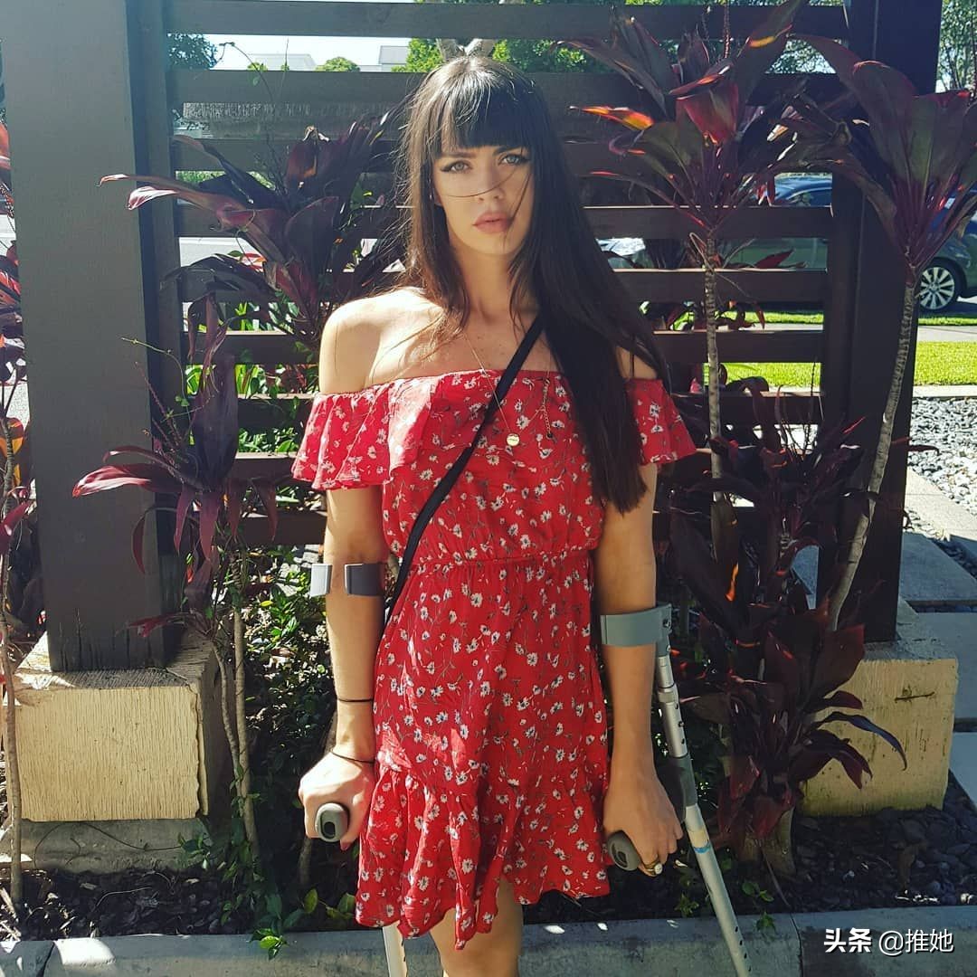 6岁被截肢，20岁被网暴，女孩儿鼓足勇气成为内衣模特