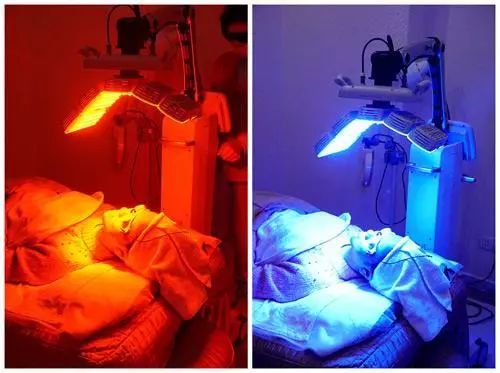 挤痘进了ICU，连下两次病危通知？这痘痘到底还能不能挤！