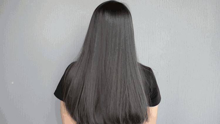 头皮屑严重如何处理好得快,头皮屑是怎么导致的如何治好