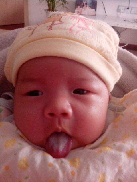 孩子脸上长斑是脾胃不好引起的吗,脾胃虚弱的宝宝身体都有什么症状