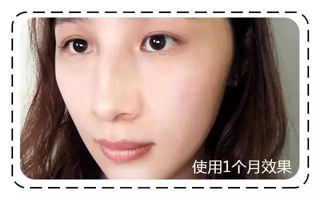 既能美白又抗老,既能美白又能抗衰老的护肤品