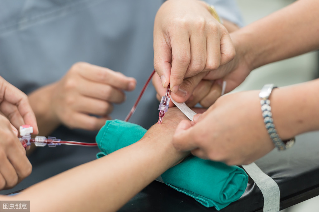 从手上扎针插管就能治子宫腺肌症——经桡动脉入路子宫动脉栓塞术